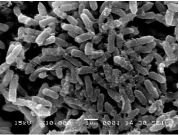 Image for - Condition Stabilization for Pseudomonas aeruginosa MTCC 5210 to Yield High Titers of Extra Cellular Antimicrobial Secondary Metabolite using Response Surface Methodology
