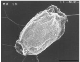 Image for - Morphological Changes Induced by Wet-heat in Bacillus cereus Endospores