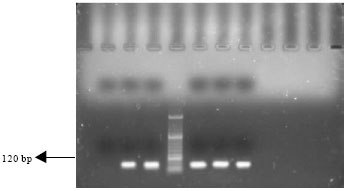 Image for - Molecular Detection of qnrA, qnrB and qnrS Resistance Genes among Salmonella spp. in Iran