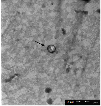 Image for - Biotechnological Applications of Two Novel Lytic Bacteriophages of Streptococcus mutans in Tooth Decay Bio-Controlling