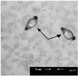 Image for - Biotechnological Applications of Two Novel Lytic Bacteriophages of Streptococcus mutans in Tooth Decay Bio-Controlling