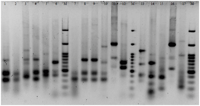 Image for - Prevalence of Carbapenem Resistant Gram Negative Bacilli Harboring blaNDM-1 Gene Isolated in a Tertiary Care Hospital