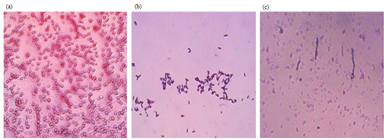 Image for - Characterization and Molecular Identification of Bacterial Isolates from Tail and Fin Rot Infected Silver Carp