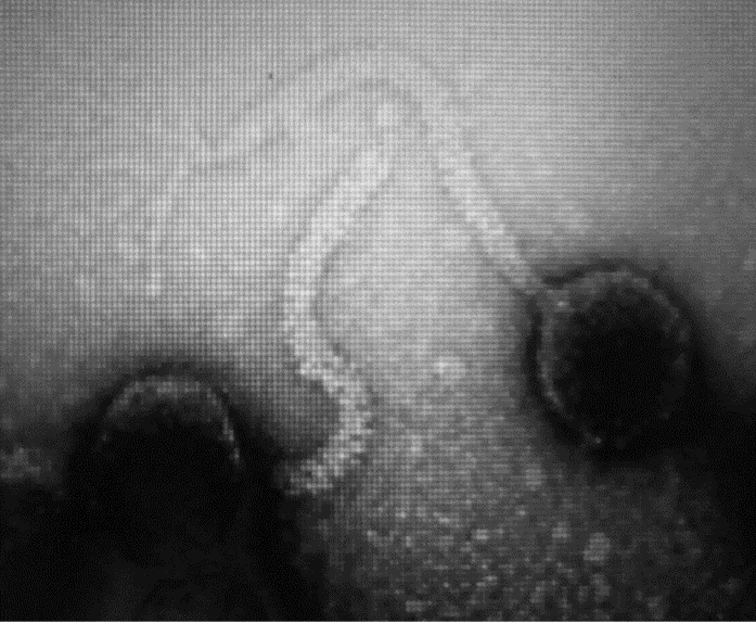 Image for - Isolation and Characterization of Escherichia coli and Salmonella Bacteriophages from Poultry