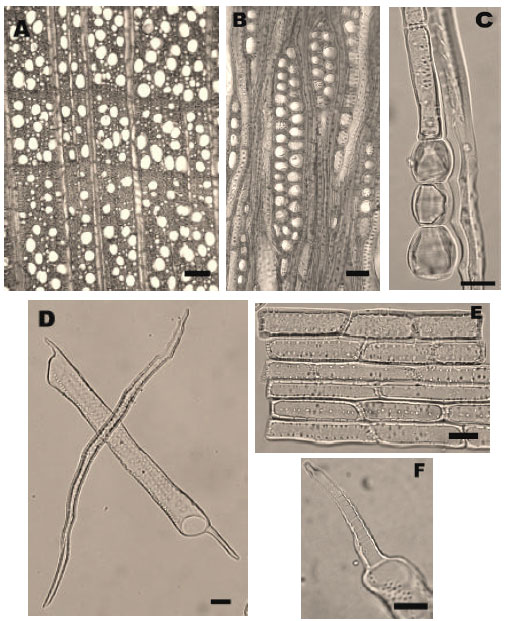 Image for - Wood Anatomy of Crataegus tanacetifolia (Lam.) Pers. (Rosaceae), Endemic to Turkey