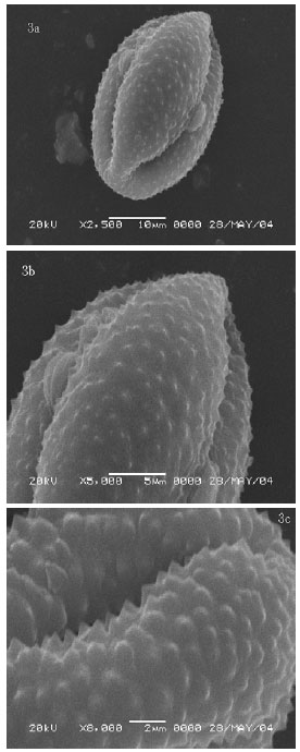Image for - Morphology, Anatomy, Ecology, Pollen and Achene Structure of Centaurea consanguinea  DC. (Sect. Acrolophus)