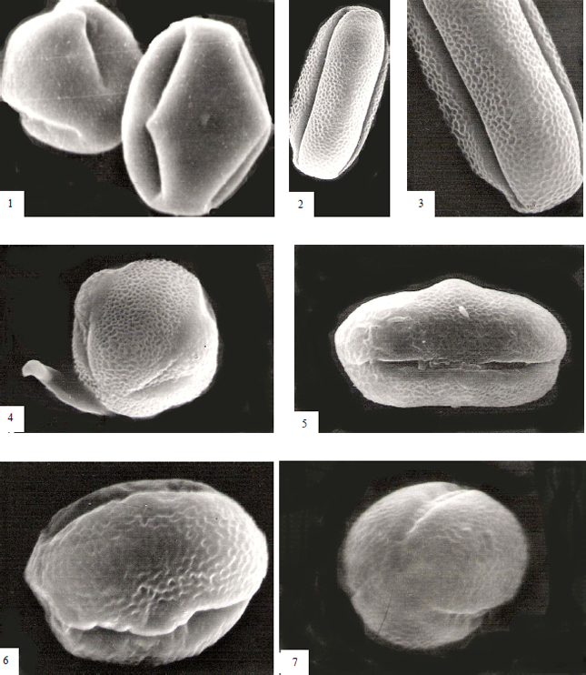 Image for - Comparative Morphology of Pollen Grains of Some Taxa of Tribe Trifolieae (Fabaceae: Papilionoideae) from Egypt