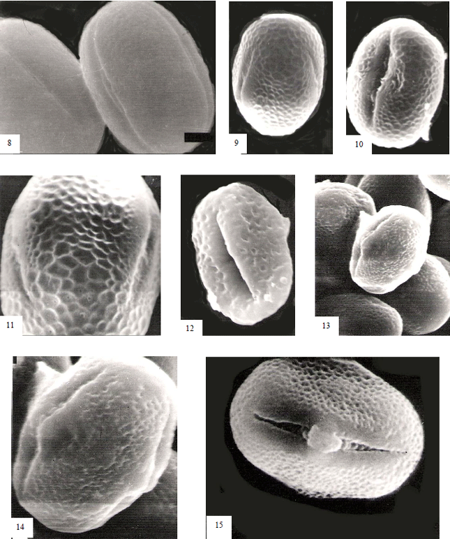 Image for - Comparative Morphology of Pollen Grains of Some Taxa of Tribe Trifolieae (Fabaceae: Papilionoideae) from Egypt