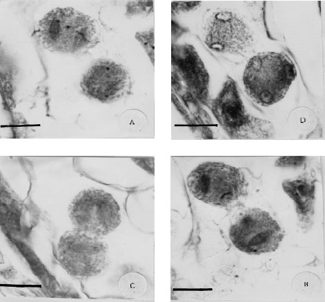 Image for - The Reasons of Sterility During Pollen Grain Formation in the Natural Tetraploid Trifolium pratense L.