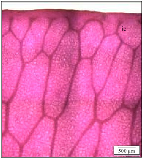 Image for - Spore Micromorphology and Anatomy of the Fern GenusHistiopterisJ. Sm. (Dennstaedtiaceae) in Peninsular Malaysia