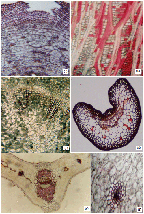 cinchona bark microscopy