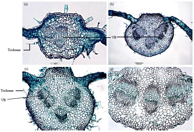 Image for - Anatomical Studies of the Midrib, Petiole and Epidermal Strip of Some Vernonia Species, from Nigeria