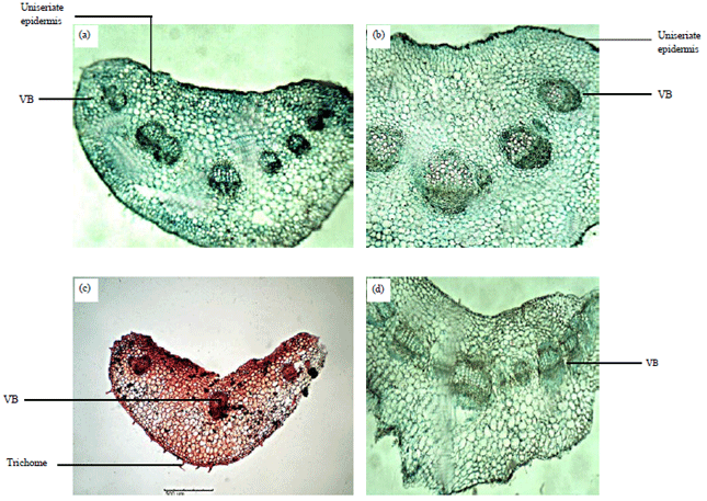 Image for - Anatomical Studies of the Midrib, Petiole and Epidermal Strip of Some Vernonia Species, from Nigeria