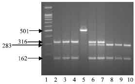 Image for - Restriction Fragment Length Polymorphism and Gene Mapping of Two Genes Associated with Milk Composition in Egyptian River Buffalo