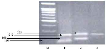 Image for - Identification of Egyptian Goat α S1-casein Alleles Using PCR-RFLP Method