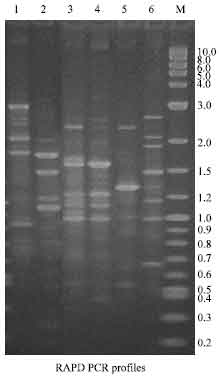 Image for - Typing of Haemolytic and Antibiotic Resistant Aeromonas hydrophila Isolated from Raw Milk of Coimbatore, South India