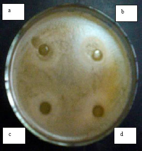 Image for - Study of the Inhibition Effects of Bifidobacterium Supernatants Towards Growth of Bacillus cereus and Escherichia coli