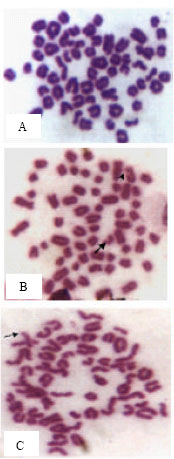 Image for - Preliminary Study on Chromosomal Aberrations Related to Brucellosis in Buffaloes and Bovine Tuberculosis in Dairy Cattle