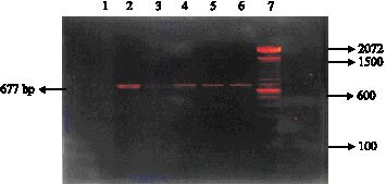 Image for - Diagnosis of Brucellosis in Dairy Animals Using Nested Polymerase Chain Reaction