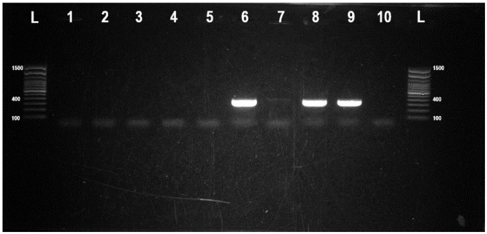 Image for - Prevalence and Antimicrobial Resistance of Campylobacter spp. in the Raw Milk of Backyard-Raised Carabaos (Bubalus bubalis) in the Philippines