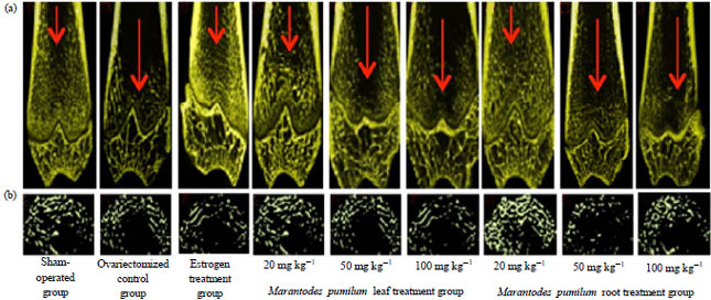 Image for - Low Dose Marantodes pumilum Leaf and Roots Extracts Preserved Bone Structure in Ovariectomized Rats