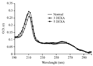 Image for - Long-Term Application of 0.1% Dexamethasone May Affect the Lens Capsular Lipids