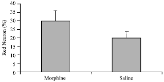 Image for - The Effects of Morphine on Cerebral Blood Flow and its Neuroprotective or Cell Damage Before and after Brain Ischemia Reperfusion in Rabbits