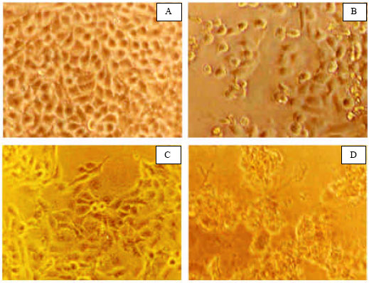 Image for - Antioxidant and Antiproliferative Effects of Flavonoids from Emilia sonchifolia Linn on Human Cancer Cells