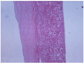 Image for - Gentamicin and Phenylbutazone Nephrotoxicity in a Calf