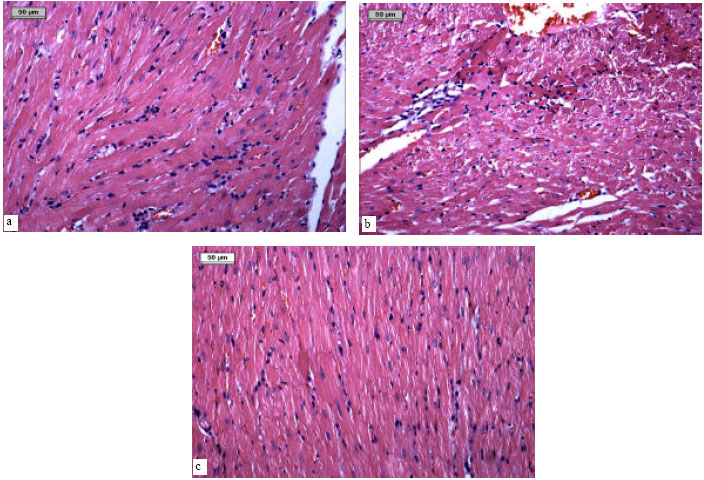 Image for - Cardioprotective Effect of Bacopa monneira Against Isoproterenol-Induced Myocardial Necrosis in Rats