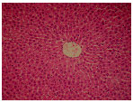 Image for - Protective Effect of Fresh Radish Juice (Raphanus sativus L.) Against Carbon Tetrachloride-Induced Hepatotoxicity