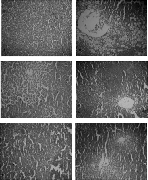 Image for - Hepatoprotective Activity of Livobond A Polyherbal Formulation Against CCl4 Induced Hepatotoxicity in Rats