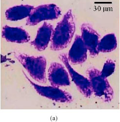 Image for - Methanolic Extract of Nigella sativa Seeds is Potent Clonogenic Inhibitor of PC3 Cells