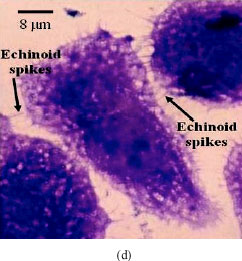 Image for - Methanolic Extract of Nigella sativa Seeds is Potent Clonogenic Inhibitor of PC3 Cells
