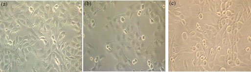 Image for - Anticancer Activity of Natural Compound (Zerumbone) Extracted from Zingiber zerumbet in Human HeLa Cervical Cancer Cells