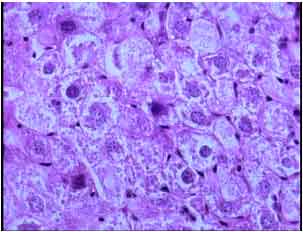 Image for - Histomorphometric Study of Hepatocytes of Mice after Using Heroin