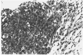 Image for - Anticancer and Biochemical Effects of Calcium Chloride on Ehrlich Carcinoma Cell-Bearing Swiss Albino Mice