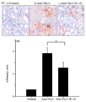 Image for - A Study on the Effects of IL-10 in Anti-Thy 1-Induced Glomerulonephritis in Rats