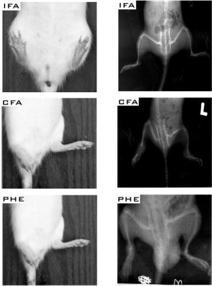 Image for - Anti-Arthritic Effects of Palisota hirsuta K. Schum. Leaf Extract in Freund’s Adjuvant-Induced Arthritis in Rats