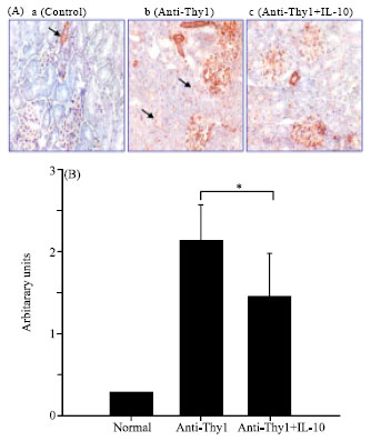 Image for - A Study on the Effects of IL-10 in Anti-Thy 1-Induced Glomerulonephritis in Rats