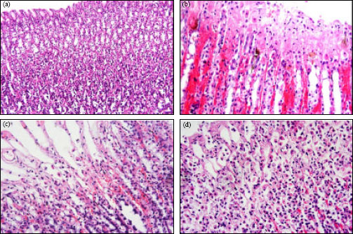 Image for - Inhibition of Ethanol-Induced Gastric Mucosal Damage by Carvedilol in Male Wistar Albino Rats: Possible Biochemical Changes