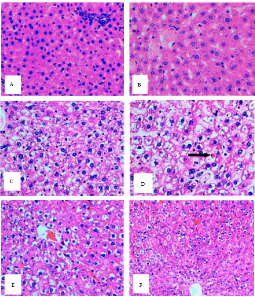 Image for - A Preliminary Study of Dexamethasone Against Ischemia/Reperfusion Liver Injury in Rats