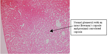 Image for - Protective Effect of Zingiber officinale on Gentamicin-Induced Nephrotoxicity in Rats