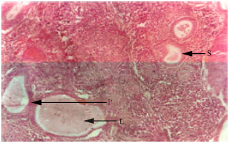 Image for - The Delayed Testicular Morphologic Effects of Doxorubicin and the  Rejuvinating Role of Grapefruit Seed Extract