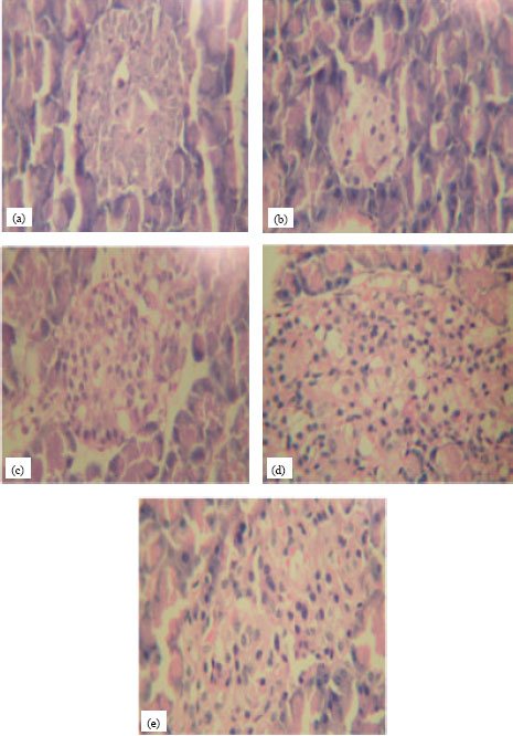 Image for - Hypoglycemic Effect of Semecarpus anacardium in Streptozotocin Induced Diabetic Rats