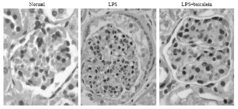 Image for - Protective Effect of Baicalein Extracted from Scutellaria baicalensis against Lipopolysaccharide-Induced Glomerulonephritis in Mice
