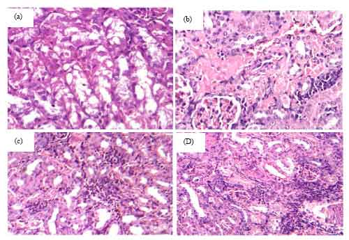 Image for - The Protective Effects of Nigella sativa Oil and Allium sativum Extract on Amikacin-induced Nephrotoxicity
