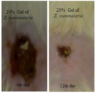 Image for - Topical Anti-inflammatory and Wound Healing Activities of Herbal Gel of Ziziphus nummularia L. (F. Rhamnaceae) Leaf Extract