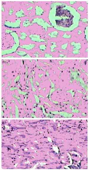 Image for - Anti-Diabetic Effects of Aqueous Ethanolic Extract of Hibiscus rosasinensis L. on Streptozotocin-Induced Diabetic Rats and the Possible Morphologic Changes in the Liver and Kidney