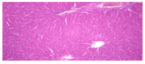 Image for - Biochemical and Histological Responses of Hepatotoxic Rats Fed Musa paradisiaca L. Supplemented Diet